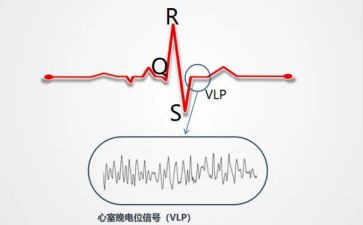b超心电室工作总结8篇